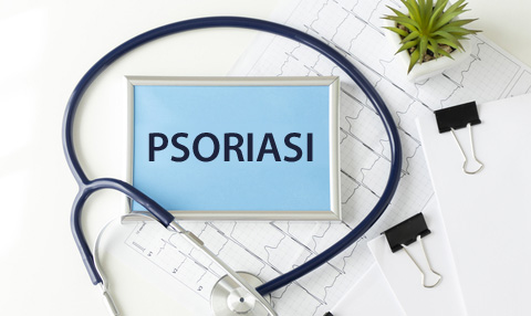 psoriasi