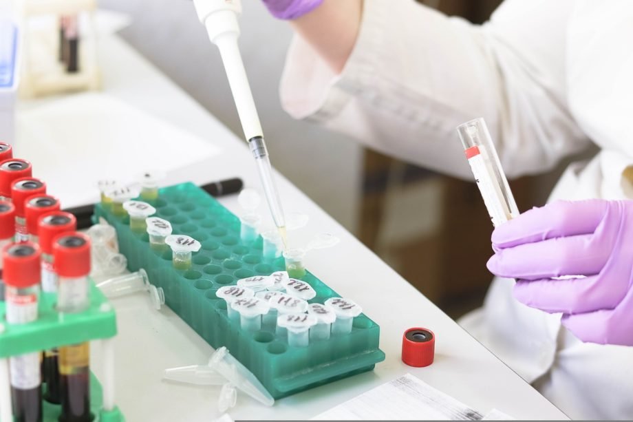 laboratory-g1bc83c8e7_1280 irccs