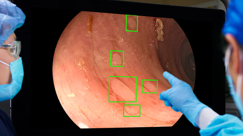 intelligenza artificiale gastroenterologia