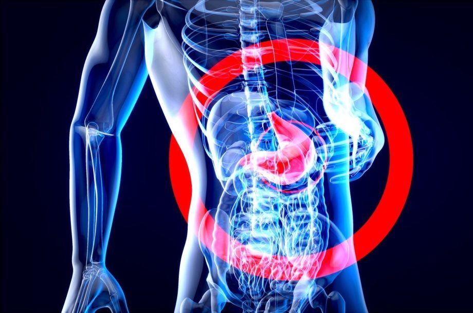 anatomy-7111055_1280 tumore stomaco