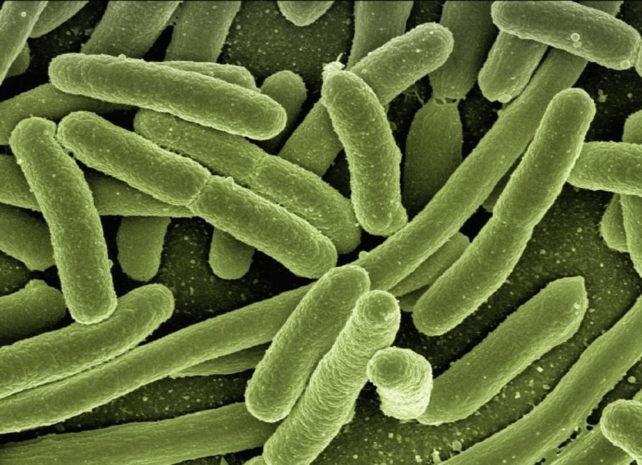 koli-bacteria-gf48c0517b_1280 E. coli