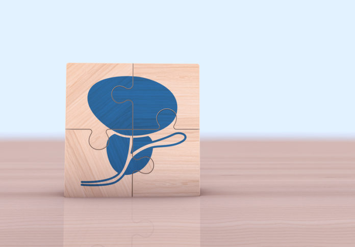 intelligenza artificiale prostata