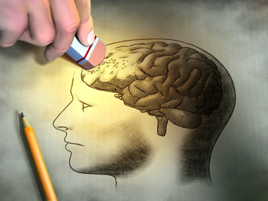 Alzheimer Alzheimer