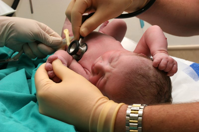 neonato