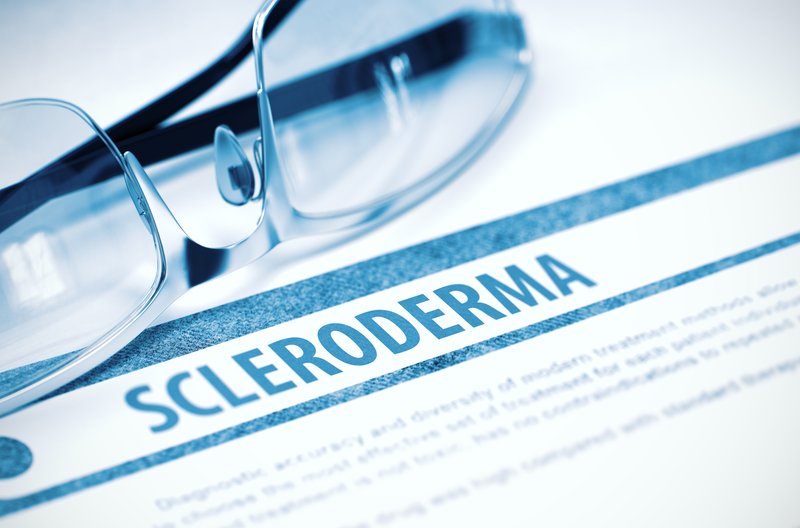 sclerodermia