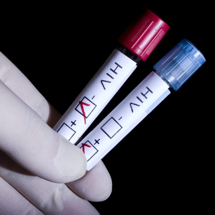 hiv